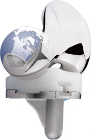 进口内轴型全膝关节假体